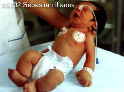 case0094-15
