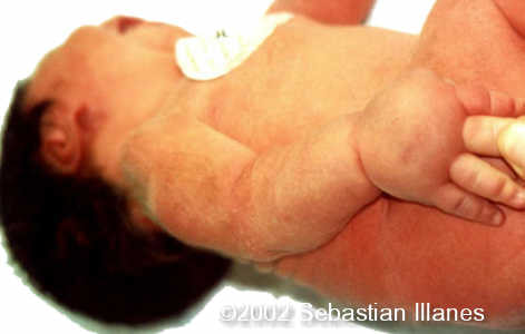 case0094-18