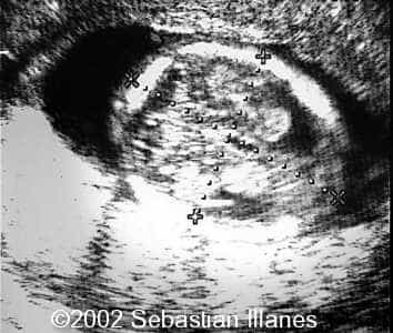 case0094-2