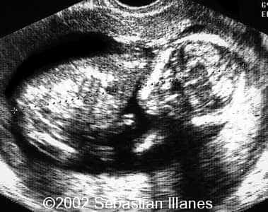 case0094-3