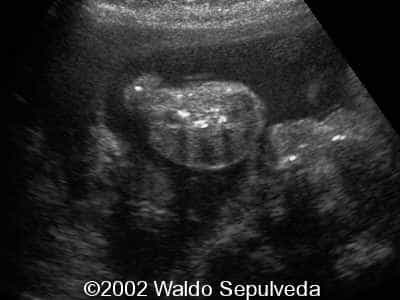 case0094-4