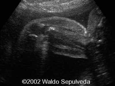 case0094-6