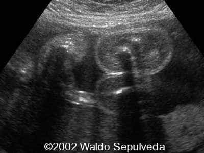 case0094-9