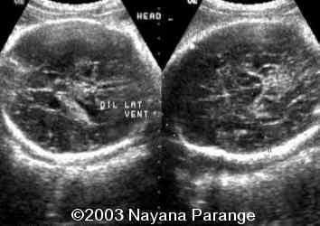 Case0095-01