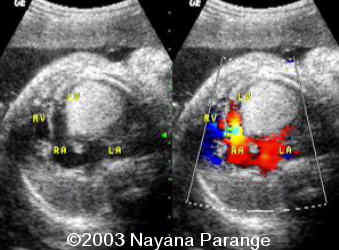 Case0095-03