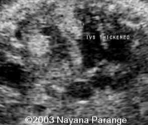 Case0095-06