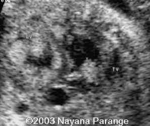 Case0095-07