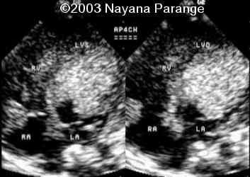 Case0095-10