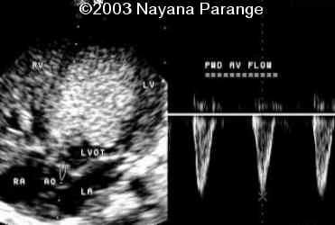 Case0095-12