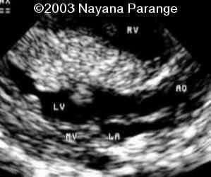 Case0095-14