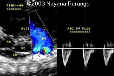 Case0095-15