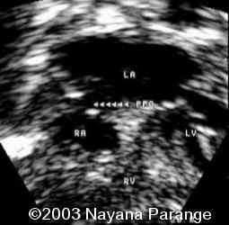 Case0095-16