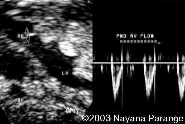 Case0095-17