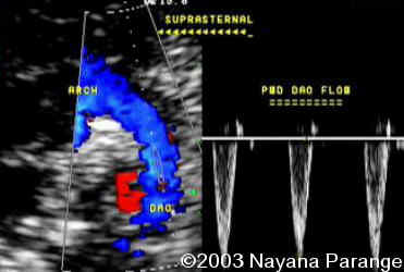 Case0095-18