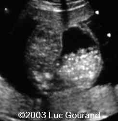 case0096-01
