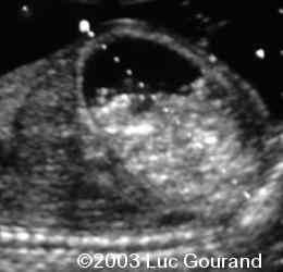 case0096-03