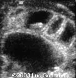 case0096-04
