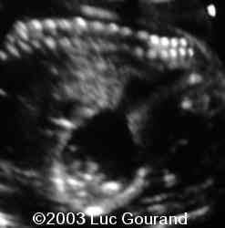case0096-05