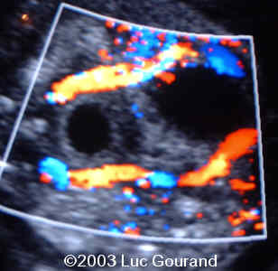 case0096-07