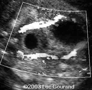 case0096-09
