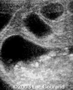 case0096-10