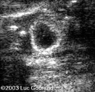 case0096-11