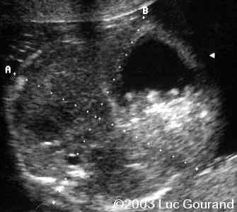 case0096-13