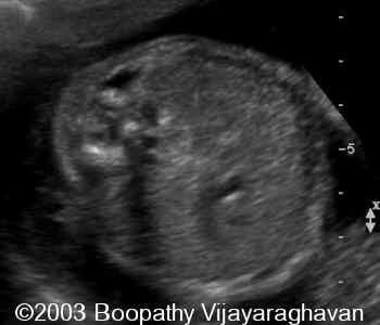 case0097-02