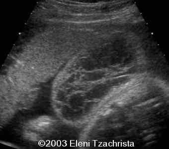 case0098-01