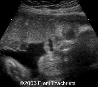 case0098-02