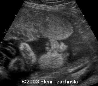 case0098-03