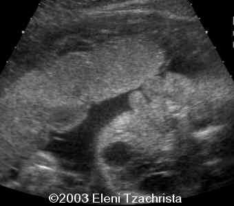 case0098-04