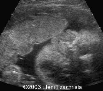 case0098-05
