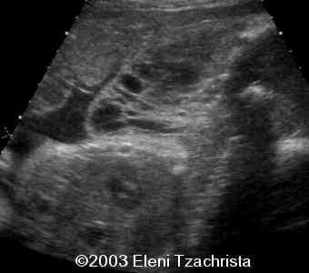 case0098-06