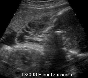 case0098-07