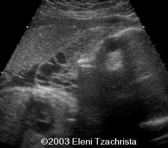 case0098-08