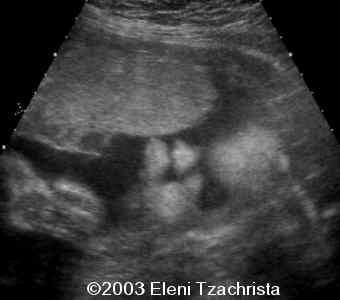 case0098-09