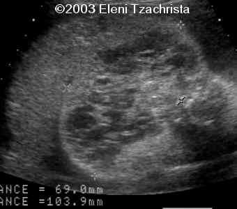 case0098-10