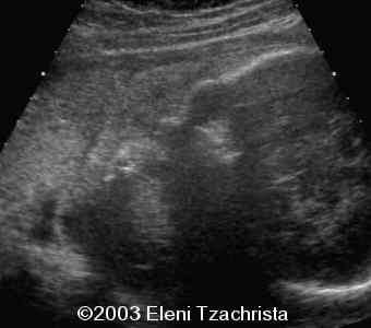 case0098-11