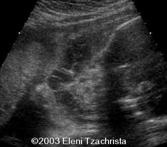 case0098-12