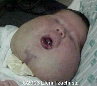case0098-15