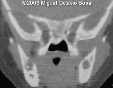 case0101-11