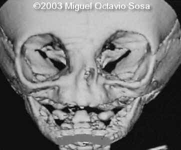 case0101-13