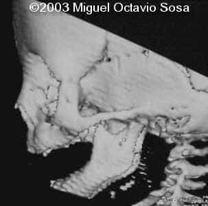 case0101-14