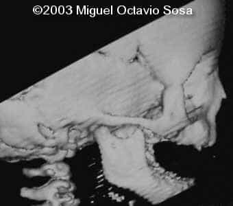 case0101-15