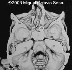 case0101-16