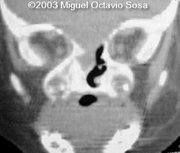 case0101-17