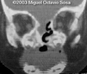 case0101-18