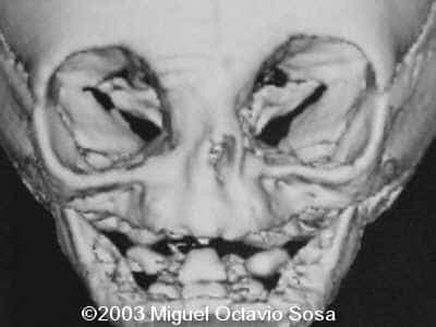 case0101-2