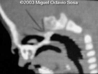 case0101-24